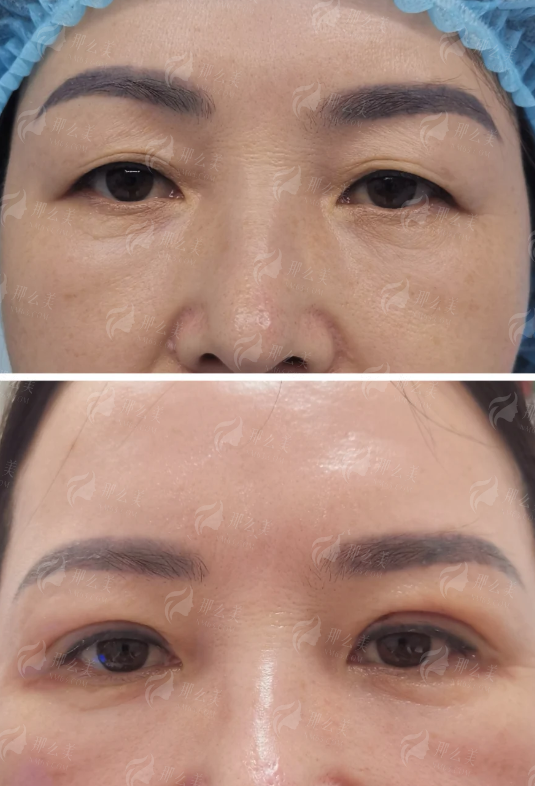 <strong>肖文明医生主要修复哪些眼部问题?</strong>