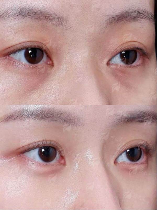 <strong>四、如何预约深圳曙光富华医疗美容孙占锋院长并做好面诊准备?</strong>