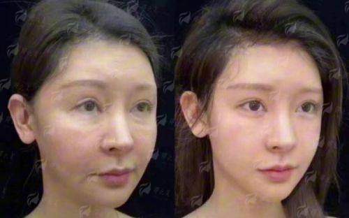 <strong>广州荔医李丰霞国内专项技术背后的骨干医生：李丰霞主事实力解析</strong>