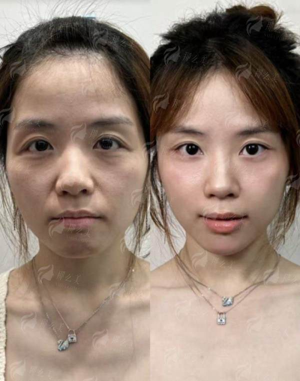 <strong>广州荔医李丰霞医生技术优势深度解析</strong>