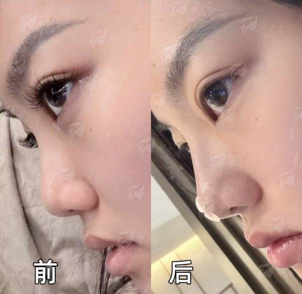 <strong>广州荔医李丰霞专项技术配套仪器与特色治疗方式</strong>
