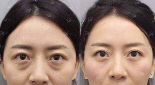 <strong>北京嘉禾整形塑妍萃的特色治疗方式与仪器护航</strong>