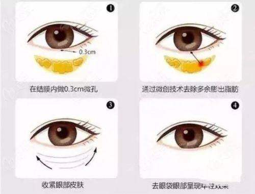 <strong>如何预约广州丽合医疗美容医院|肖强唇鼻裂面诊?</strong>