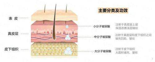 <strong>骨干医生核心解析：李春财主事的面部吸脂技术优势何在？</strong>