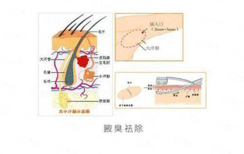 <strong>广州丽合医疗美容医院|肖强鼻部整形:服务质量与术后护理</strong>