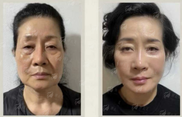 <strong>广州丽合医疗美容医院|肖强鼻部整形:如何成功预约?</strong>