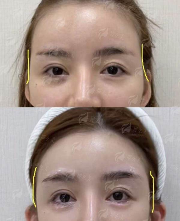 <strong>探秘北京新星靓医美:实力与口碑并存的抗衰殿堂</strong>