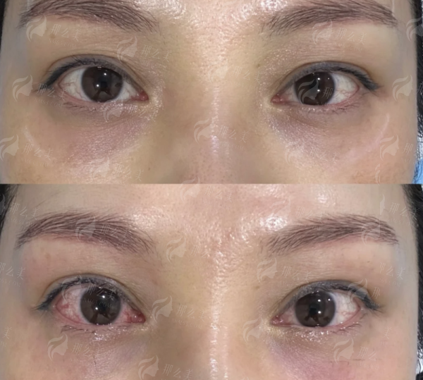 <strong>北京新星靓医美眶周结构复位项目价格与收费标准</strong>