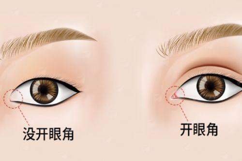 <strong>籍建华轮廓项目的特色治疗方式与“黑科技”仪器</strong>