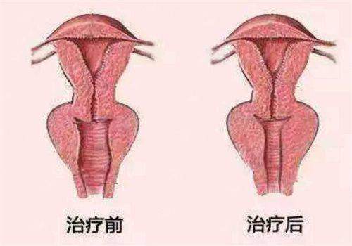 <strong>三、选择西安画美整形医院的叶瑜医生,有哪些突出的优势?</strong>