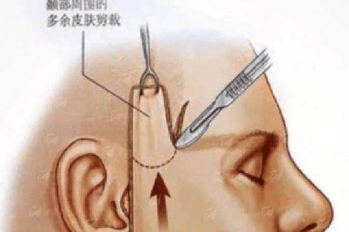 <strong>三、深圳阳光整形医院的罗志敏医生坐诊与预约攻略</strong>