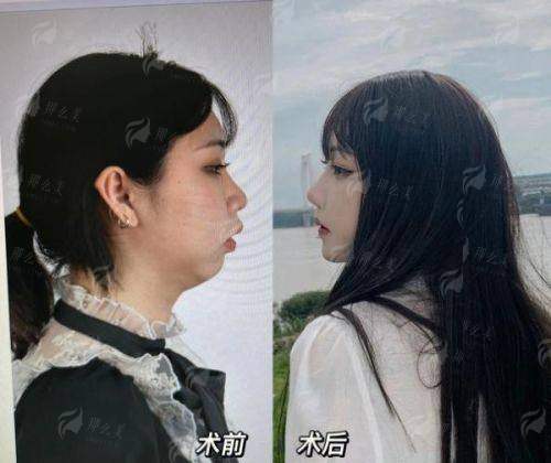 <strong>四、如何预约郑州大学第二附属医院正美医疗美容的李会勇医生?</strong>