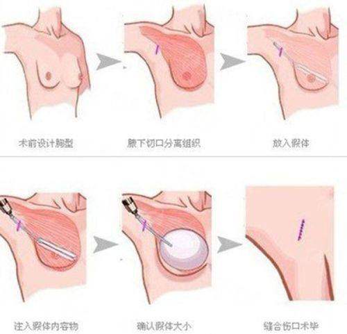 <strong>总结与选择建议</strong>
