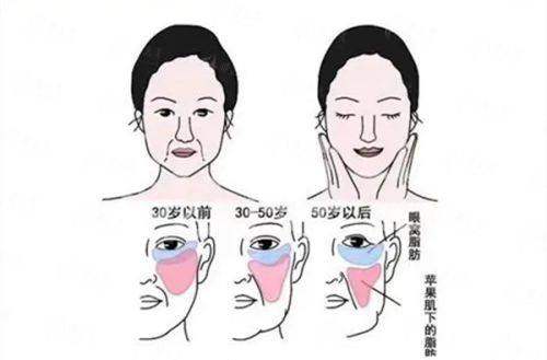 <strong>三、在<strong>珠海新颜医疗美容门诊部</strong>找<strong>王倜</strong>医生做眼修复有何不同?</strong>