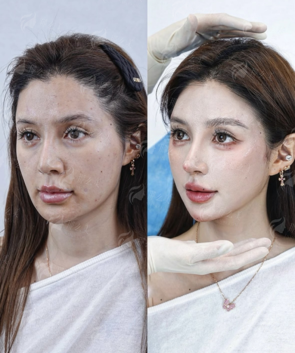 <strong>二、<strong>在深圳曙光富华医疗美容，陈明星医生擅长修复哪些具体皮肤问题？</strong></strong>