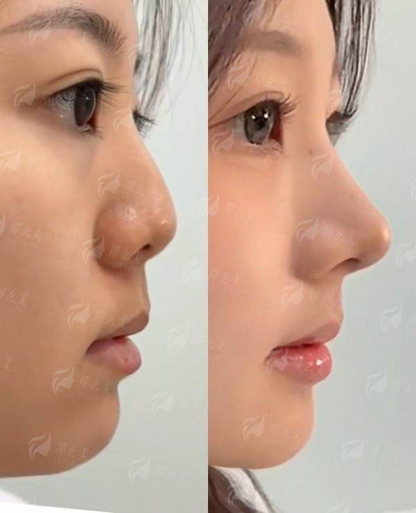 <strong>从预约到术后:成都素美的全流程服务体验</strong>
