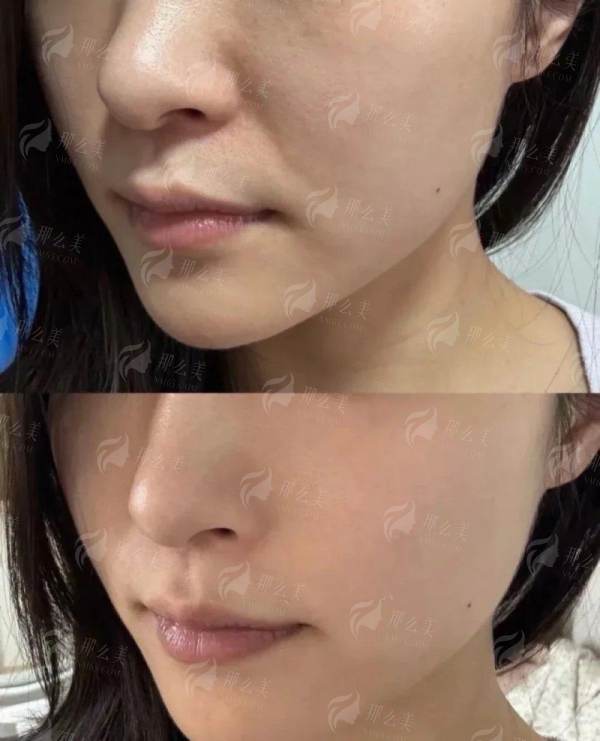 <strong>三、上海丽质整形美容的卢九宁,面诊与手术体验如何?</strong>