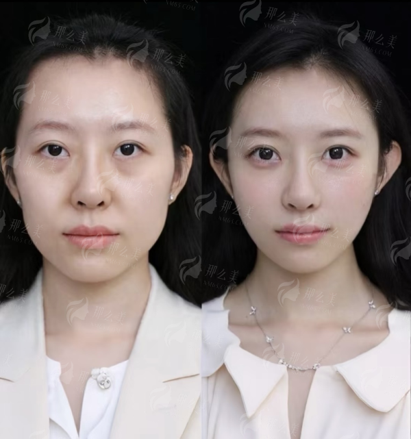 <strong>三、重庆长城骨科医院的杨志强医生坐诊与预约攻略</strong>