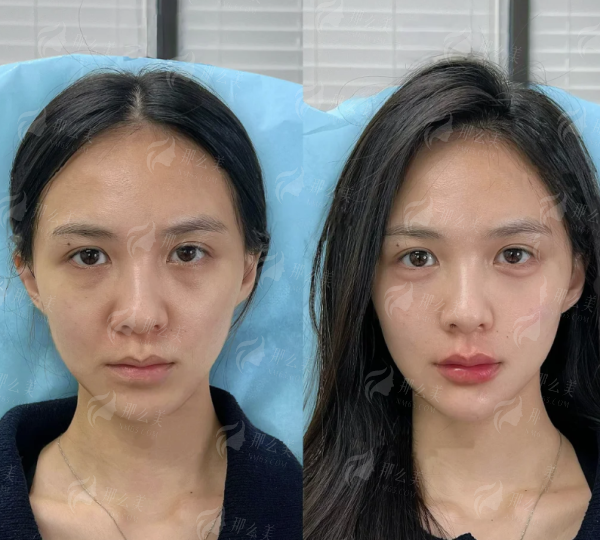 <strong>四、如何理性选择广州焕新颜医疗美容及术后护理</strong>