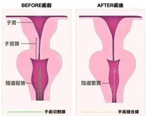 <strong>总结与预约指南：如何开启您的定制化脂肪填充之旅？</strong>