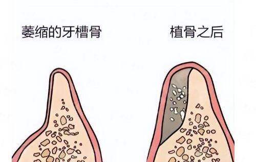 <strong>从预约到修复:上海伯思立鼻修复的全流程服务</strong>