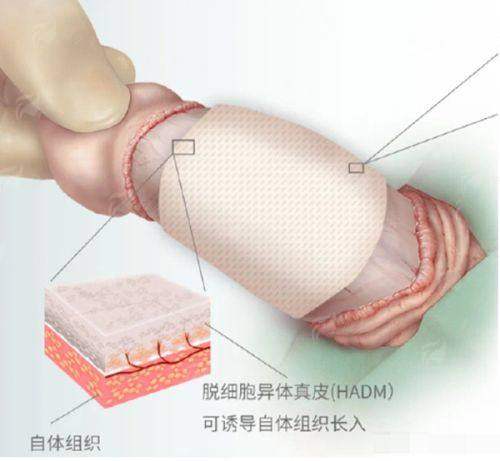 <strong>如何预约上海华美整形王荣锡3s小颜复位术?</strong>
