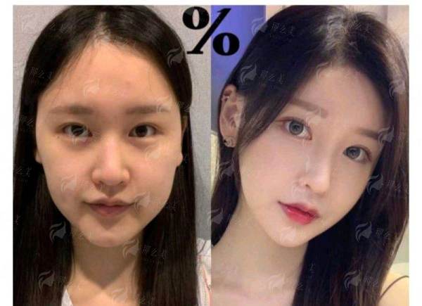 西安艺星徐智慧馒化修复怎么样？医生简介+特色项目解析，附预约方式大公开，新颜智尚小程序一键预约！