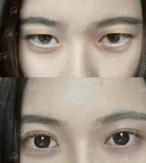 <strong>上海丽质整形美容的服务质量与术后护理体系</strong>