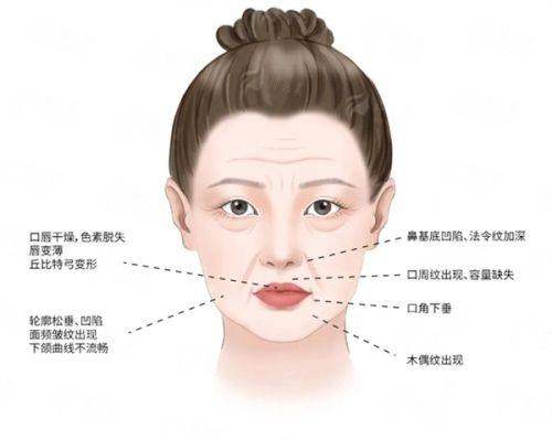 <strong>核心技术解析:刘志刚的“仿生重睑”与“四层修复”强在哪?</strong>