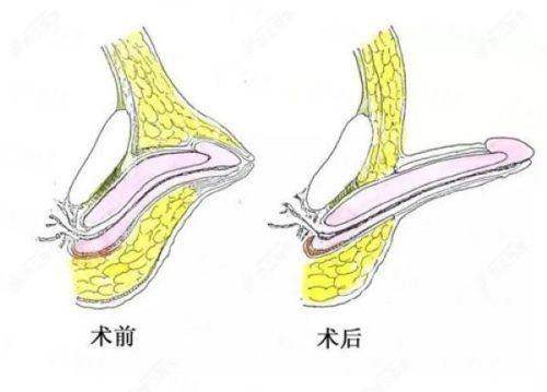 <strong>成都新华医院祛眼袋的特色仪器与治疗方式</strong>