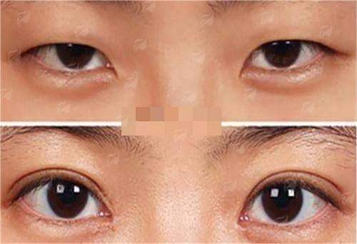 <strong>总结：为什么选择长沙祺美肖征刚院长是明智之选？</strong>