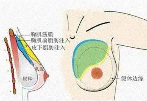 <strong>揭秘邓珂医生的祛眼袋核心技术优势</strong>