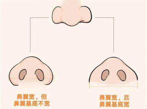 <strong style="color: rgb(255, 0, 0);">五、 求美者更关心:全层胶原灌注的价格与成效维持时间?</strong>