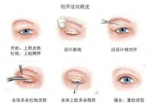 <strong>听听她们怎么说:关于北京嘉禾整形王广的口碑与实例</strong>