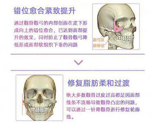 <strong>面对众多高端假体，肖征刚院长如何为患者做选择？</strong>