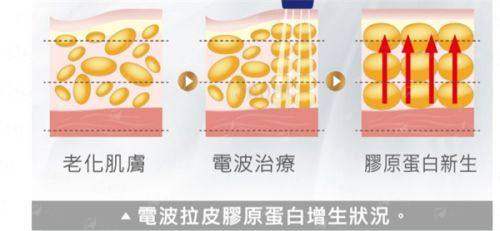 <strong>上海改脸型找谁?听听过来人的真实评价与口碑</strong>