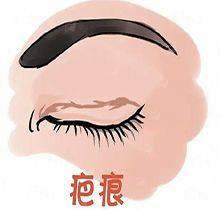 <strong>袁雪景医生的核心技术“不剃发植发”,究竟强在哪里?</strong>