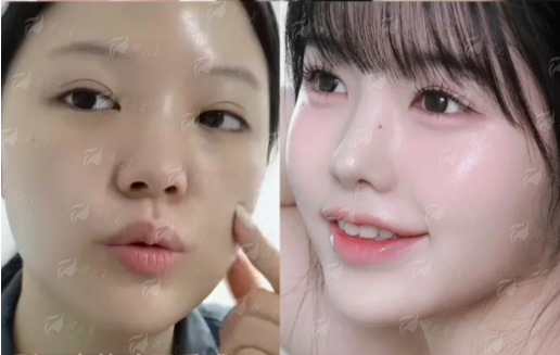 <strong>求美者更关心的价格与收费标准</strong>