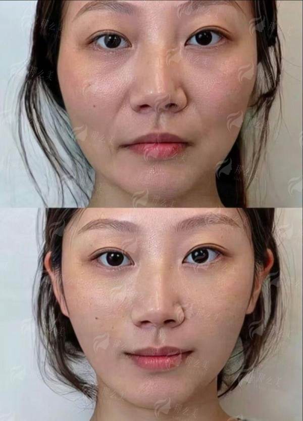 <strong>在长沙祺美做胸部整形，价格区间和收费标准是怎样的？</strong>
