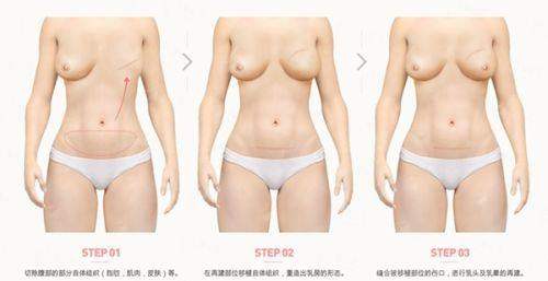 三、<strong>北京艺美硕德王东就诊体验怎么样？</strong>