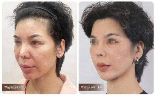 四、<strong>北京漾格医疗美容医院李在郁怎么预约面诊?</strong>