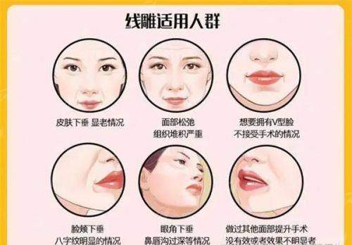 <strong>二、北京禾美嘉医疗美容门诊任学会擅长哪些项目</strong>