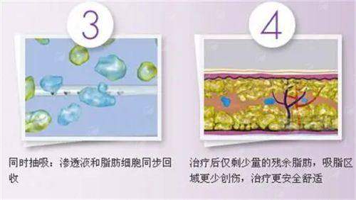 四、<strong>怎么预约长沙祺美(胸眼)整形肖征刚面诊?</strong>