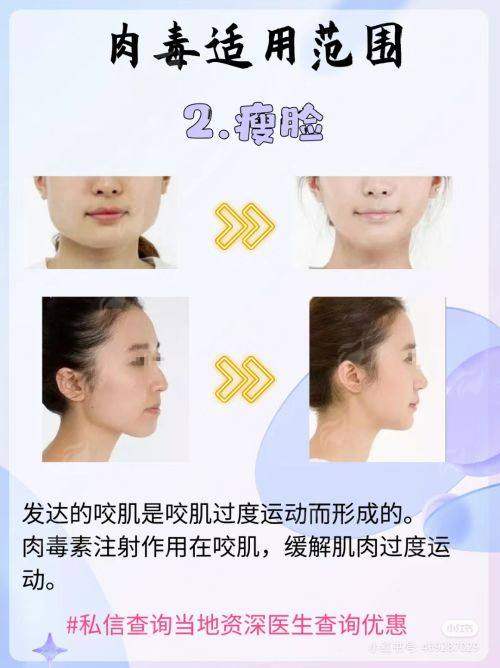<strong>三、北京加减美医疗美容门诊部黄寅守做项目价格参考</strong>