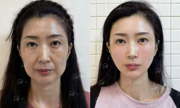 四、<strong>怎么预约李健坐诊的上海华美整形?</strong>