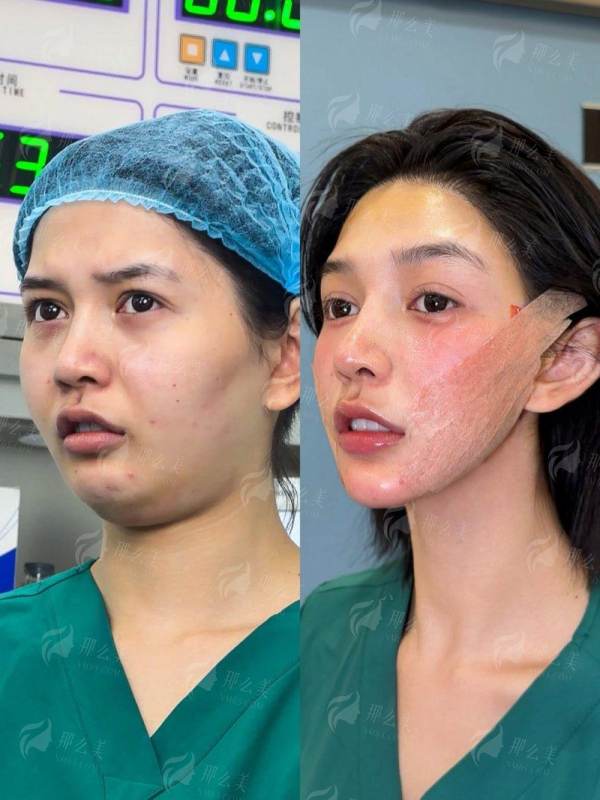 <strong>三、重庆华美整形医院陈德法做隆胸价格参考</strong>
