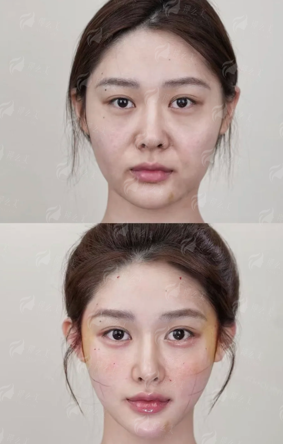 <strong>二、北京加减美医疗美容门诊部黄寅守擅长哪些项目</strong>
