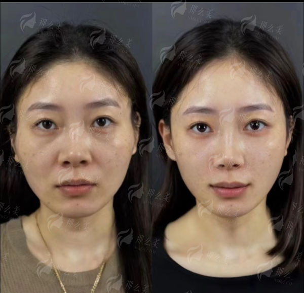 <strong>三、上海爱尚丽格医疗美容门诊杜园园眼修复项目价格参考</strong>
