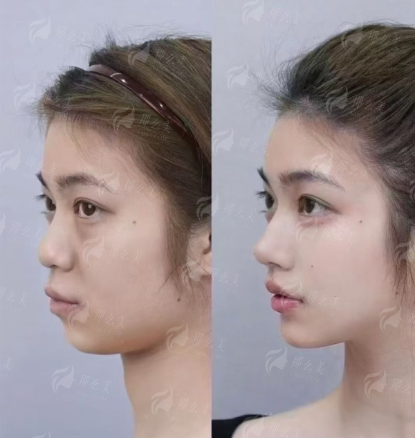 三、<strong>郑州杨丽美颜整形医院的医生团队介绍</strong>
