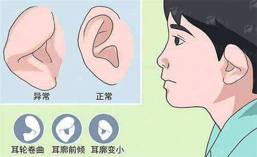 三、<strong>成都八大处整形口腔找章庆国做小耳畸形矫正价格怎么样?</strong>